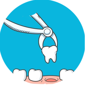 Tooth extraction